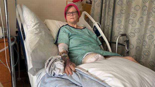 Woman's right leg amputated after waiting 8 days for bed at Winnipeg's HSC to treat open wound