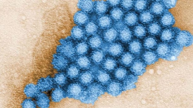 Norovirus cases are on the rise. Here's what you need to know about this nasty bug